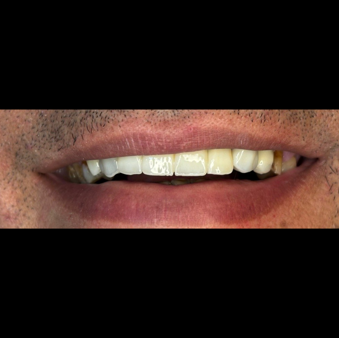Resultado Odontológico 5