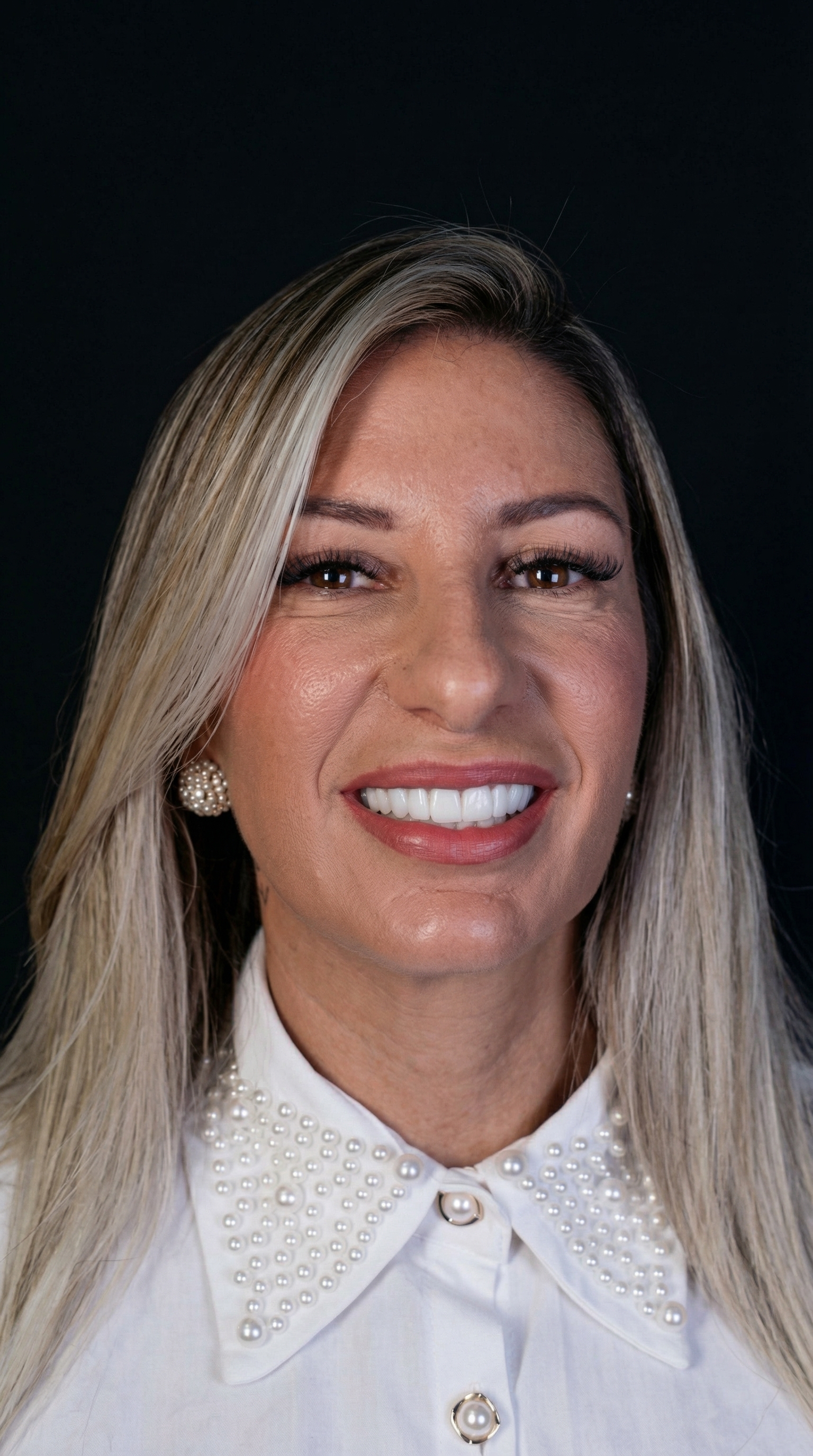 Implantes e Prótese Protocolo