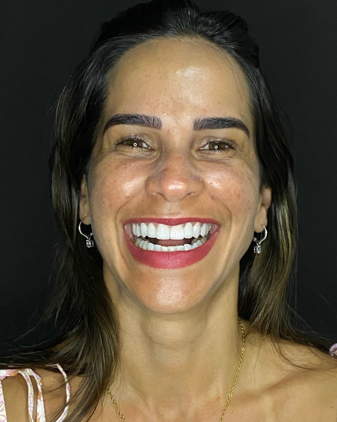 Sorriso Neoclin Odontologia
