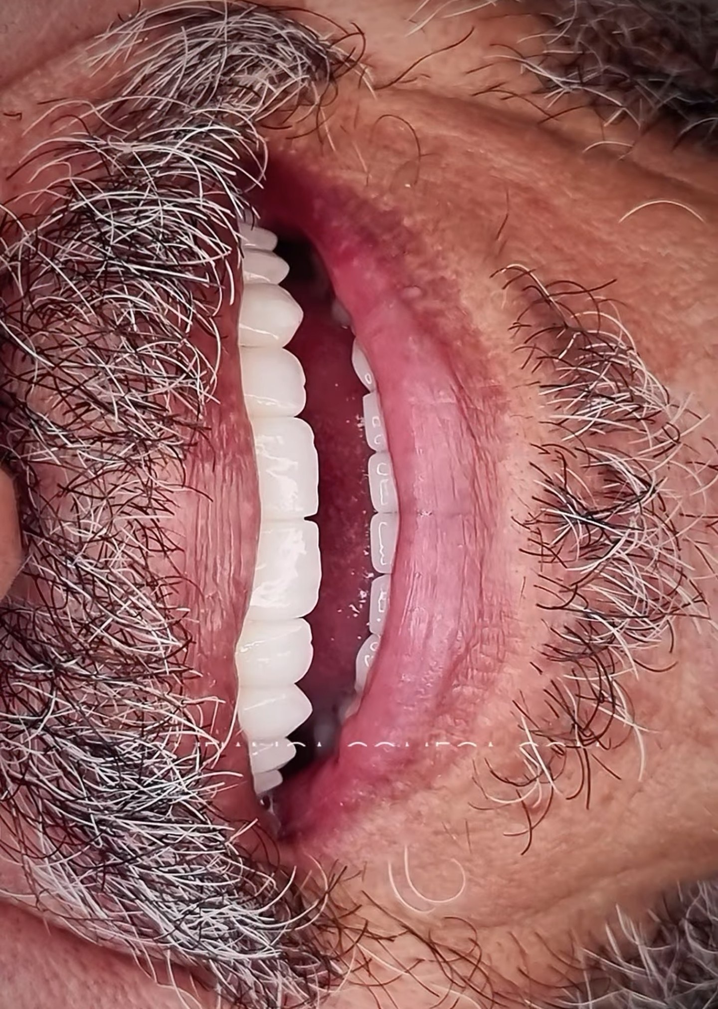 Resultado Odontológico 3