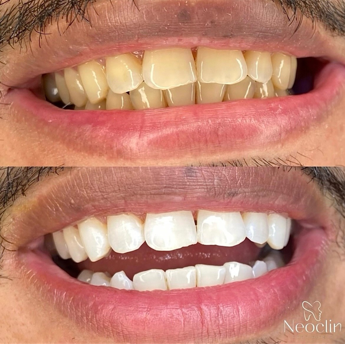 Resultado Odontológico 5