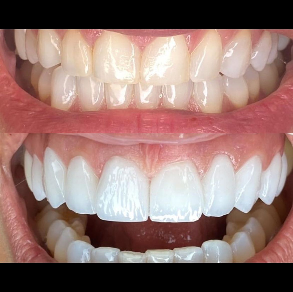 Resultado Odontológico 6